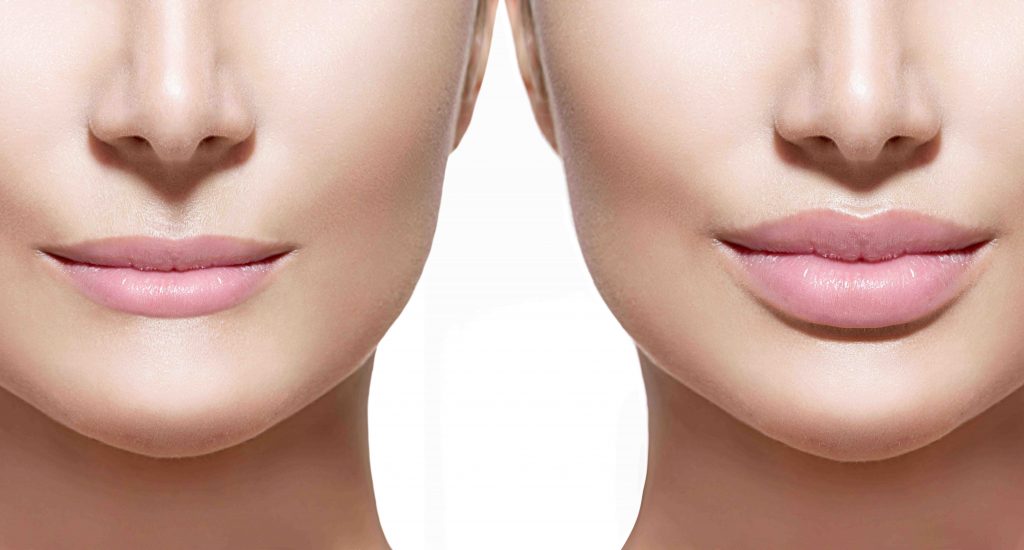 Cosmetic Injections Melbourne